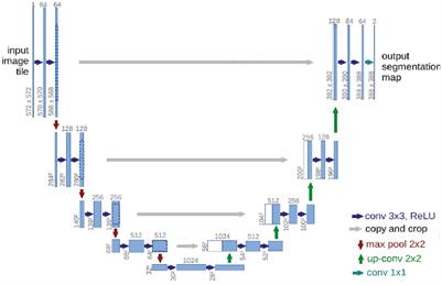 RAD-UNet: Research on an improved lung nodule semantic segmentation algorithm based on deep learning